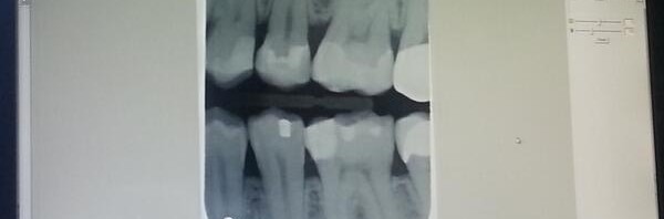 Thought while awaiting dental exam: if we regrew t…